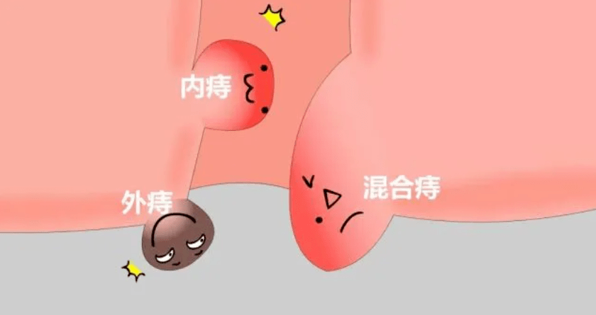 ̯@ʲô@ôʹ(dng)Ѫ˨